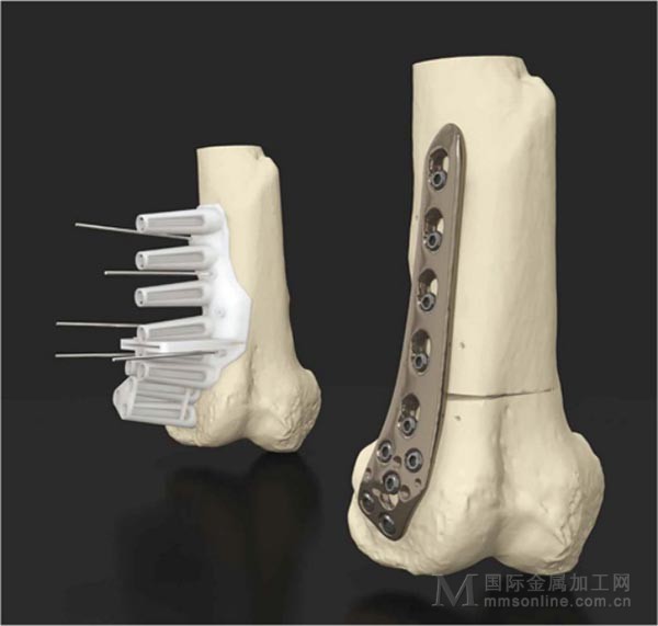 7 Classical Application of High-Precision Cutting Tools in Medical Part Processing 3